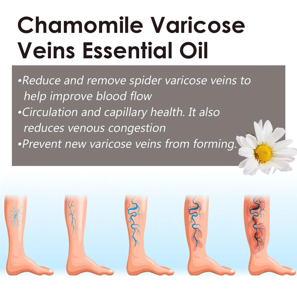 10ml bottle of chamomile essential oil for leg skin care and massage.