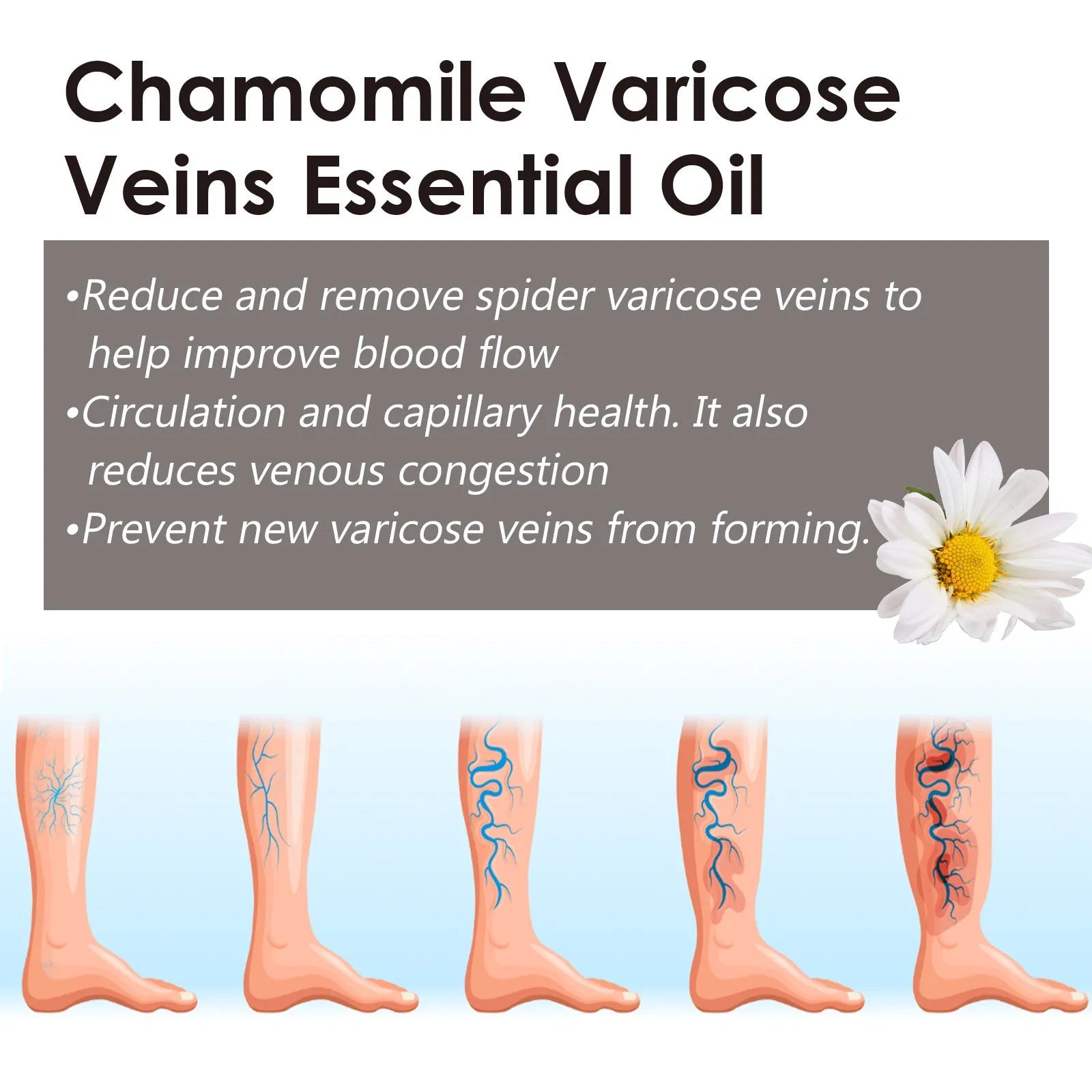 10ml bottle of chamomile essential oil for leg skin care and massage.