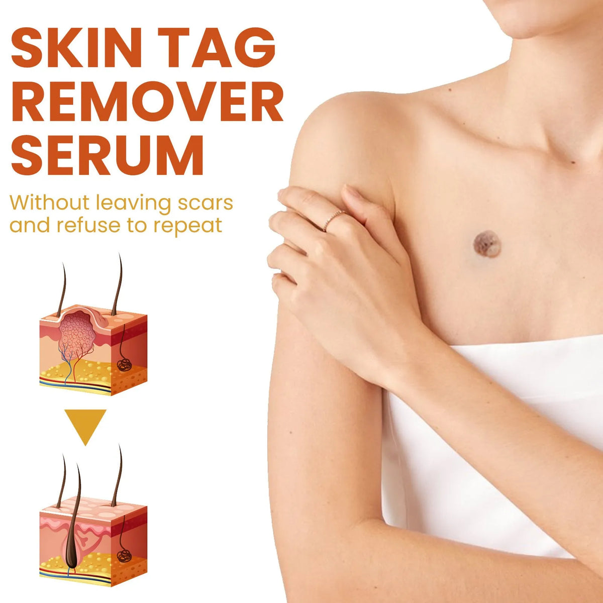 15ml skin care solution in a 2.5 x 2.5 x 7cm plastic bottle for cleansing skin and fading moles