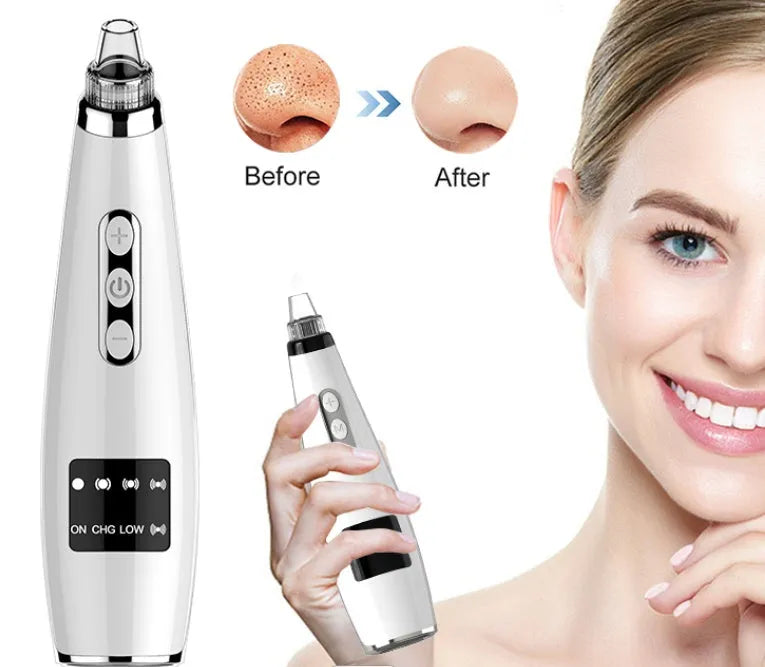 Electric blackhead suction instrument, black, with LCD display, 5 modes, compact 173x44x40mm