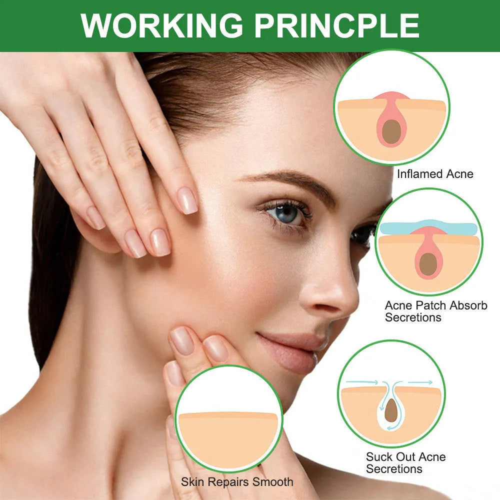 Green colloidal invisible acne patches on a 14*9cm sheet with 7mm, 10mm and 12mm spot covers