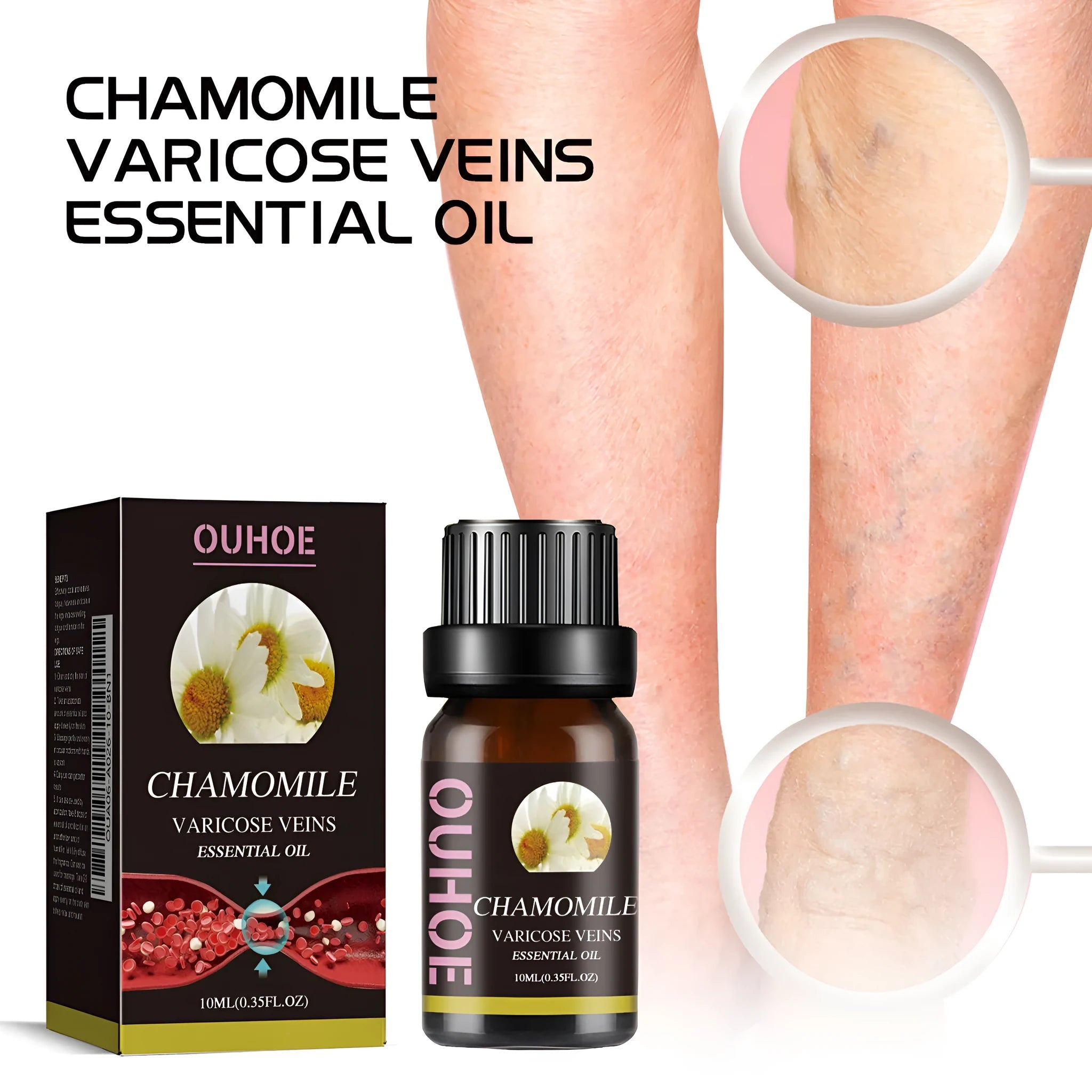 10ml bottle of chamomile essential oil for leg skin care and massage.
