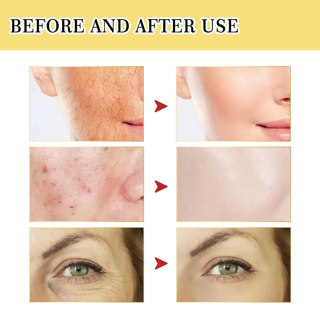 100ml snail collagen facial serum bottle with original formulation for skincare
