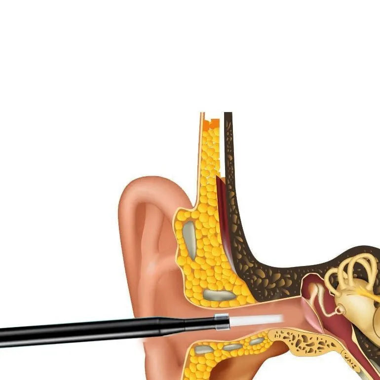 Visual ear pick for children in black, blue, or pink, with light, connecting to PC or Android phone for earwax cleaning.