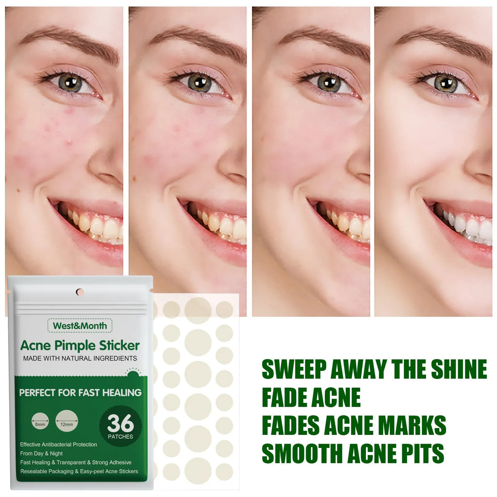 Repairing essential oil acne patch waterproof and breathable with tea tree and marigold oil