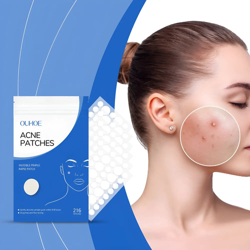 216-count acne patches with tea tree oil and vitamin E for facial care