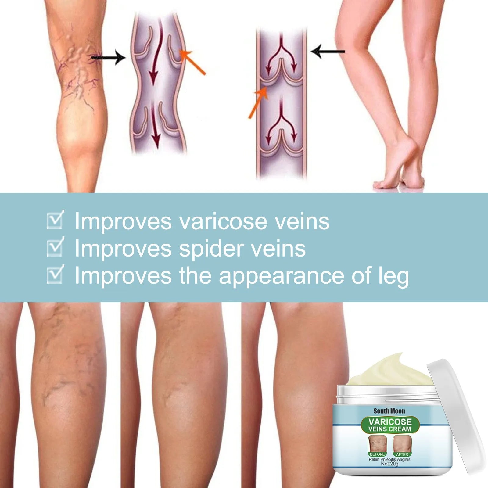 20g tub of vein repair cream for visible leg veins and bulging tendons.