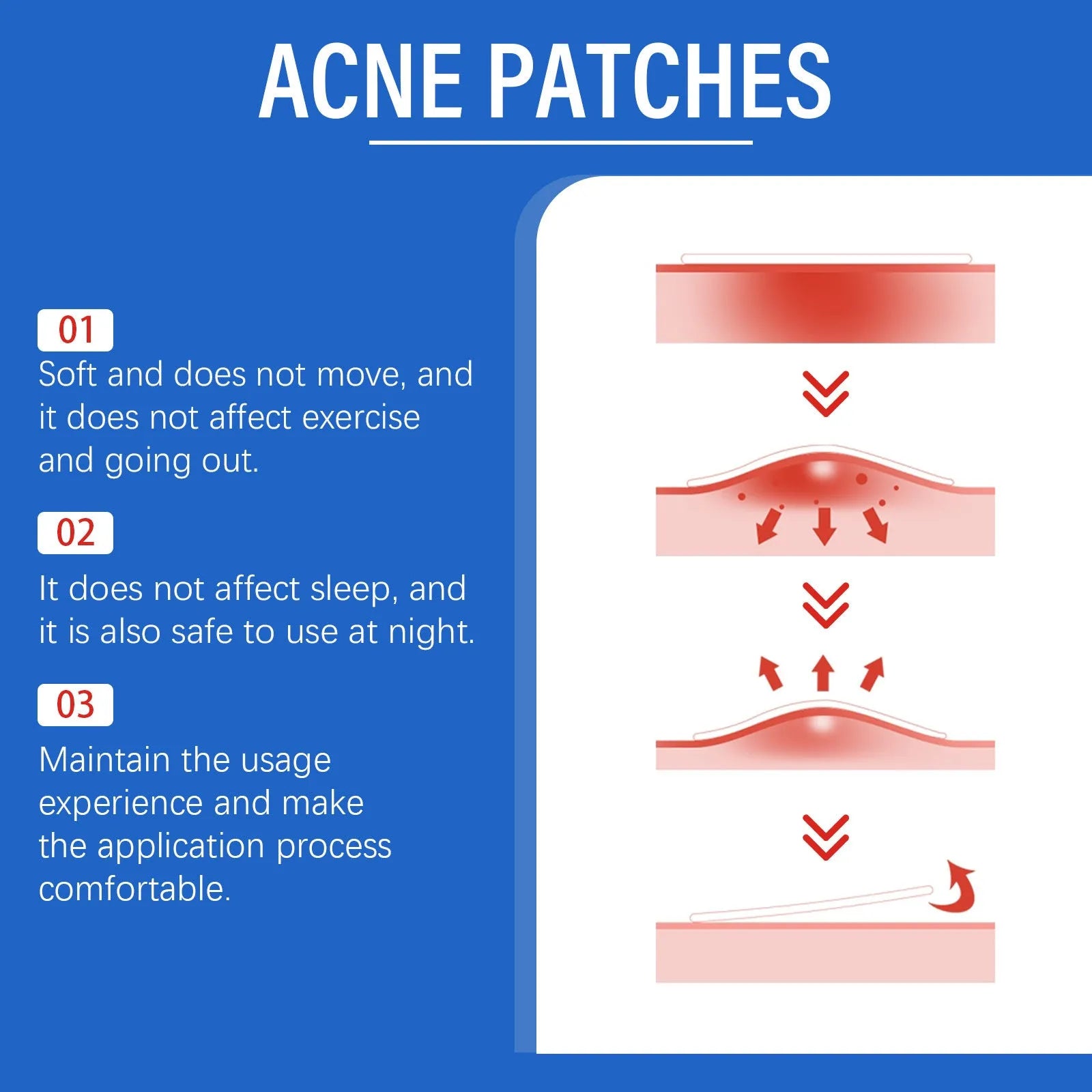 216-count acne patches with tea tree oil and vitamin E for facial care