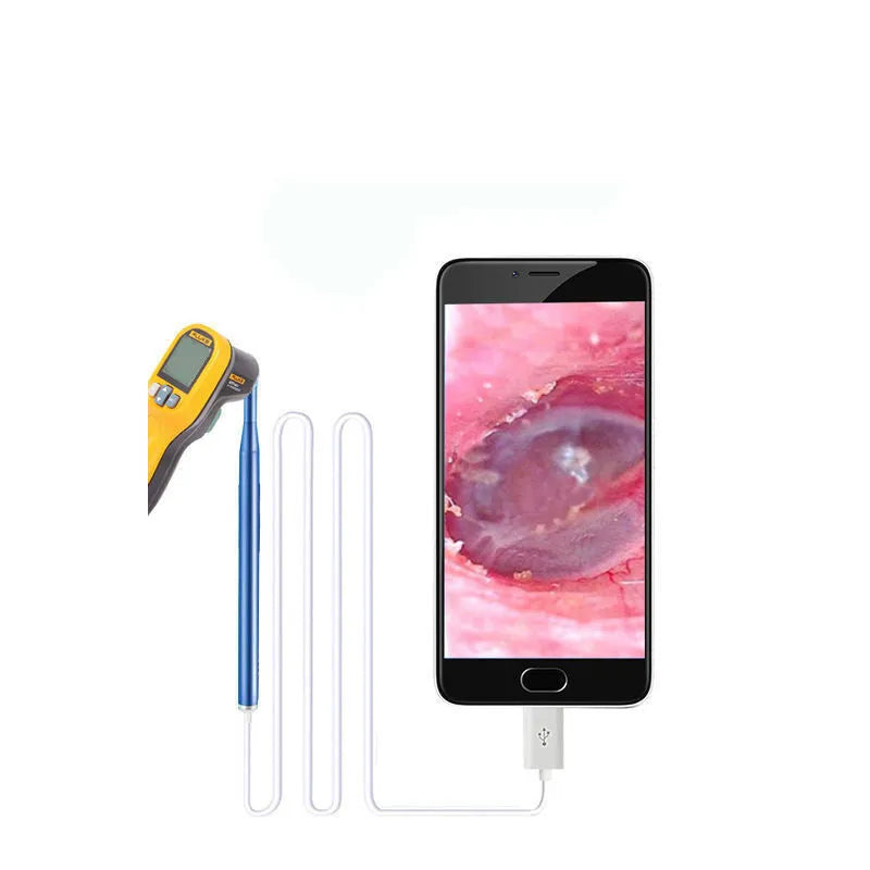 Visual ear pick for children in black, blue, or pink, with light, connecting to PC or Android phone for earwax cleaning.