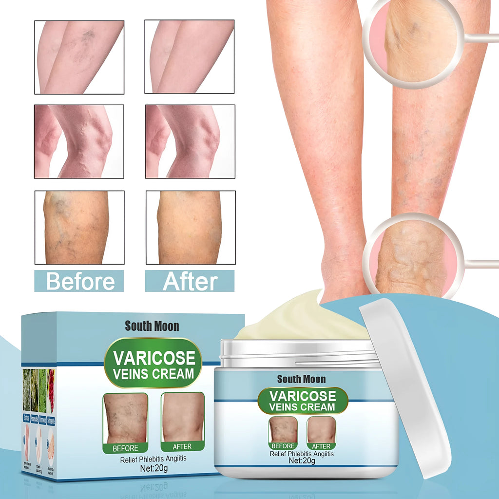20g tub of vein repair cream for visible leg veins and bulging tendons.