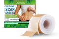 Roll of clear silicone scar sheet with measurements showing 4cm width and 150cm length for scar treatment.