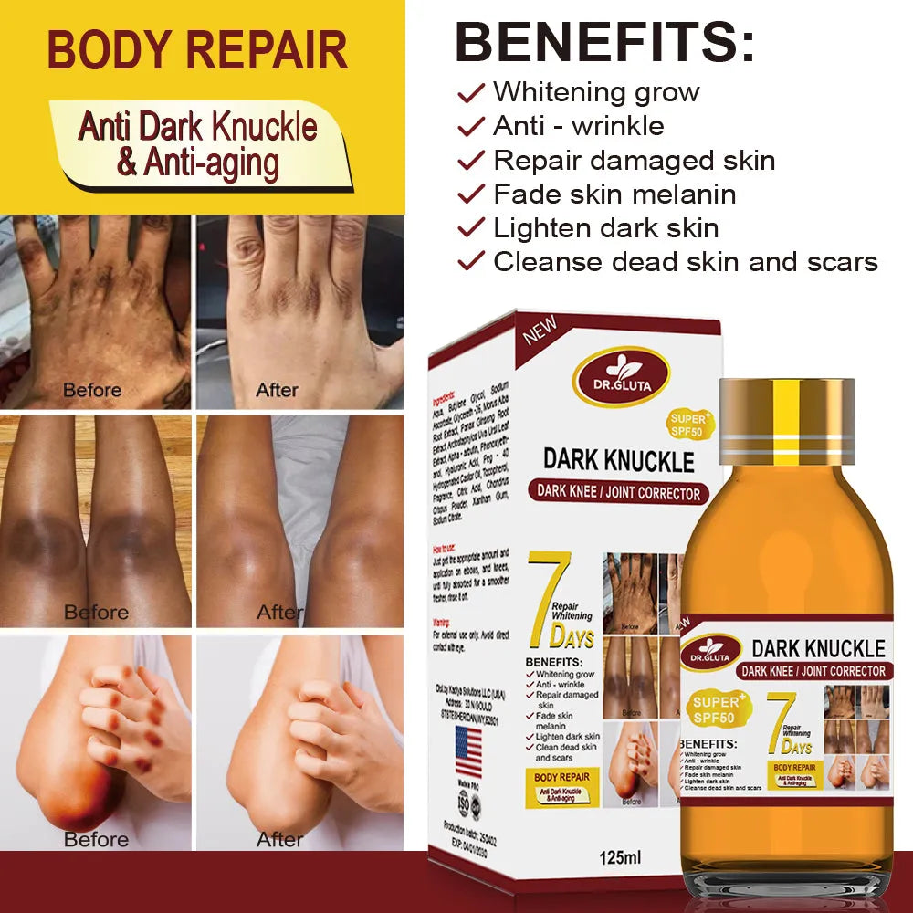 Dark Knuckle Serum 125ml bottle with premium plant extracts for skin whitening and anti-wrinkle care