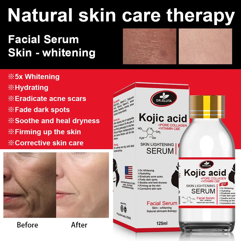 125ml kojic acid serum bottle for uneven skin tone and dull skin, natural skin care face serum