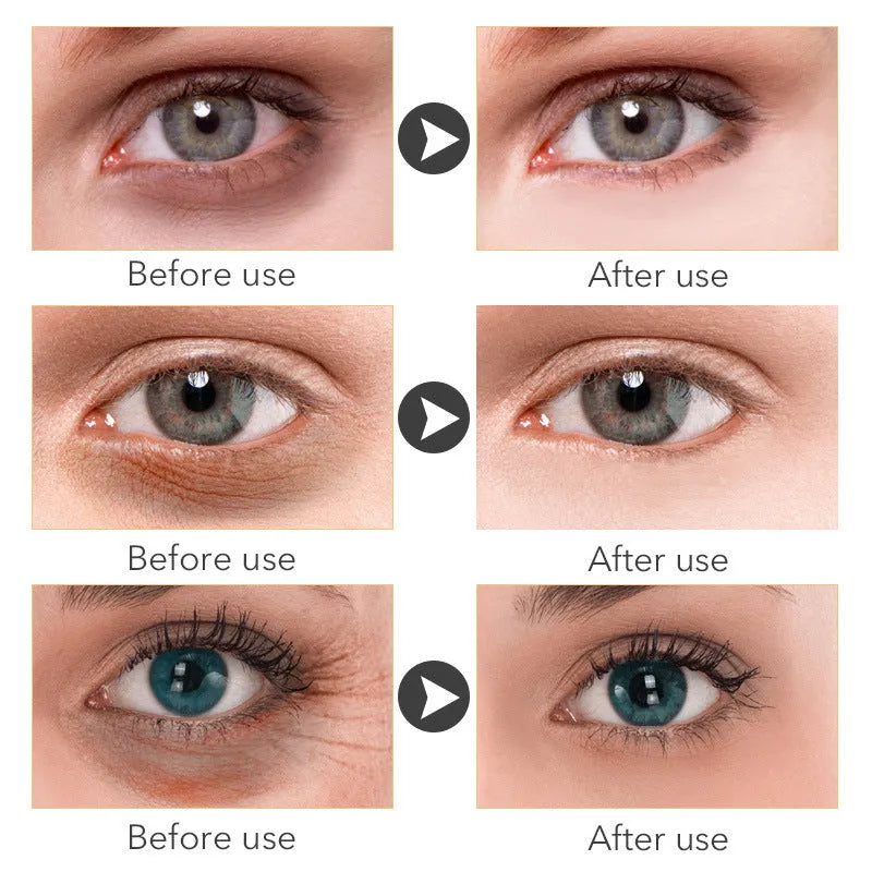 30ml eye cream container for women's under-eye skincare with moisturising formulation