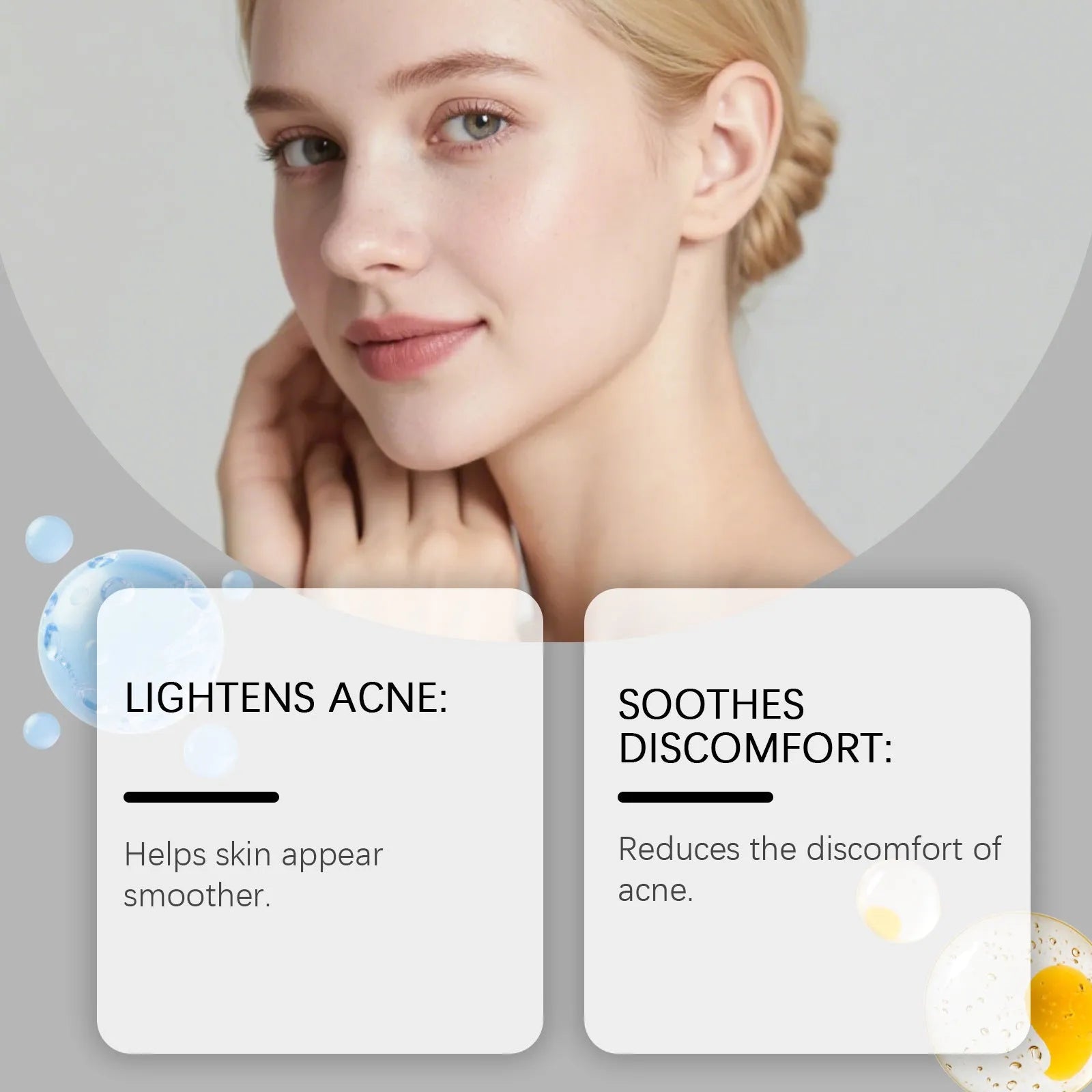 Pack of 80 breathable facial acne patches for spot treatment.