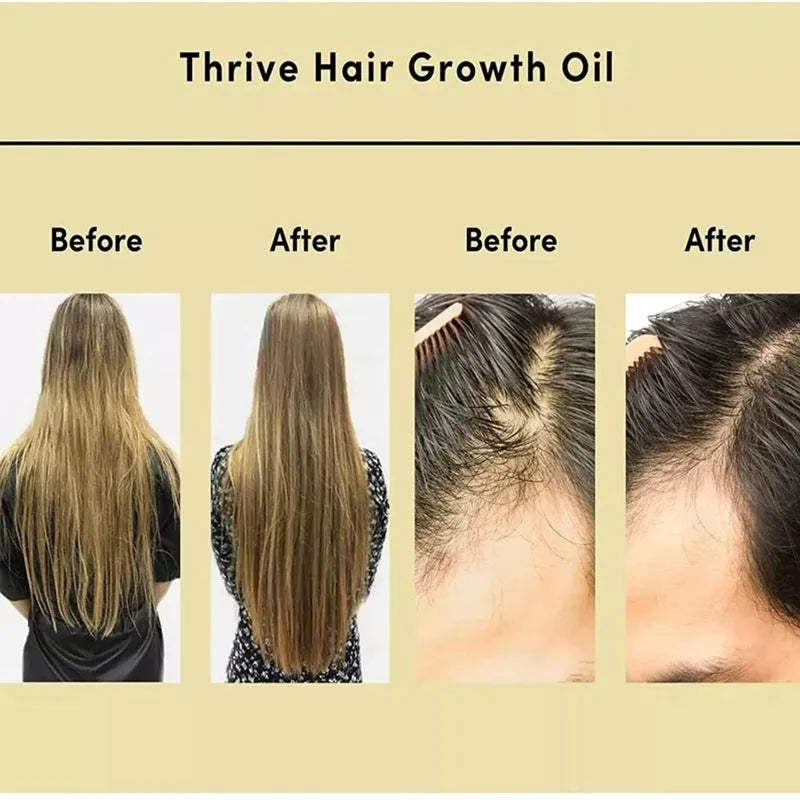 Yellow rosemary hair essential oil in a 60ml bottle for split ends and scalp treatment.