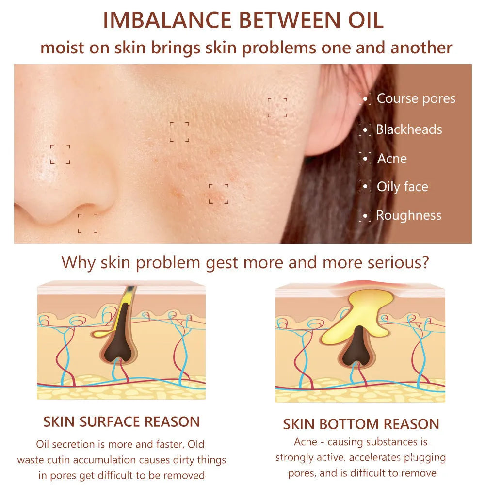 30ml bottle of Salicylic Acid Hydrating Facial Essence Serum
