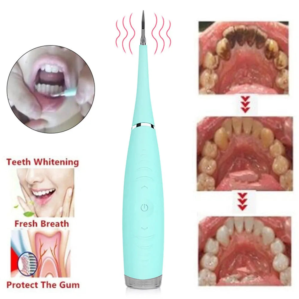 Pink and blue waterproof electric dental scaler tool on a bathroom counter with charging cable.