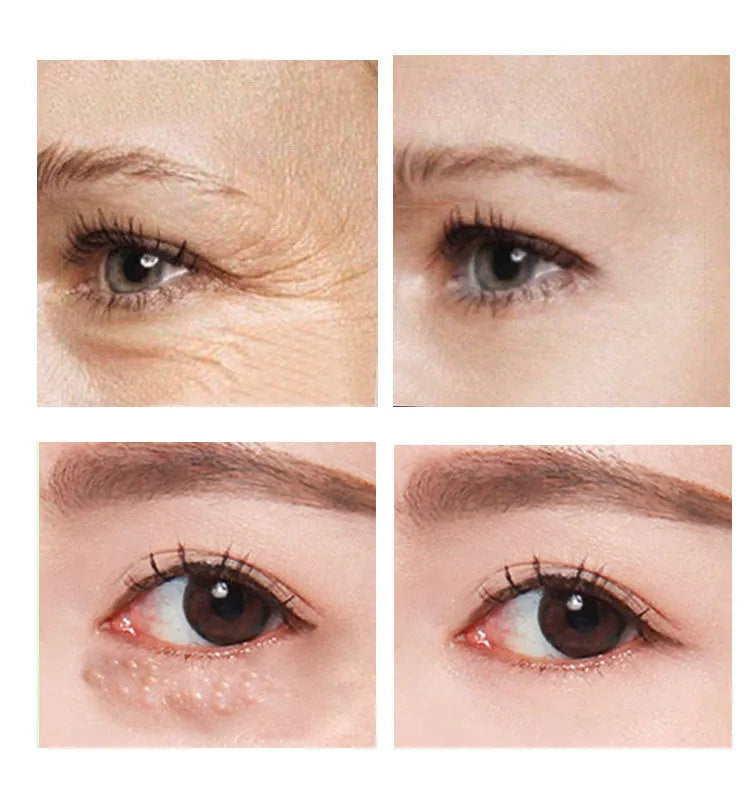 30ml eye cream container for women's under-eye skincare with moisturising formulation